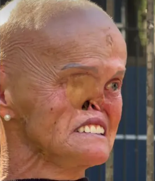Hilária